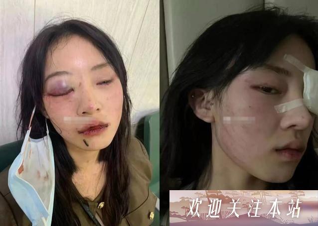 女网红猪有蹄遭家暴，暴力冲突事件引发热议