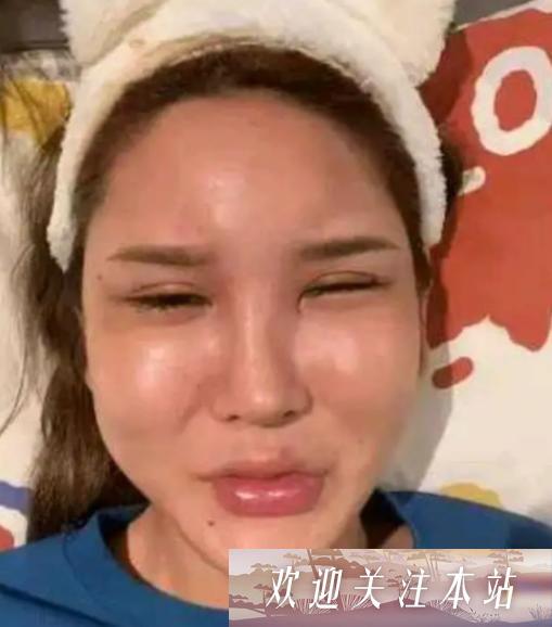 整形热潮：美容的风险与桃花宝宝的教训